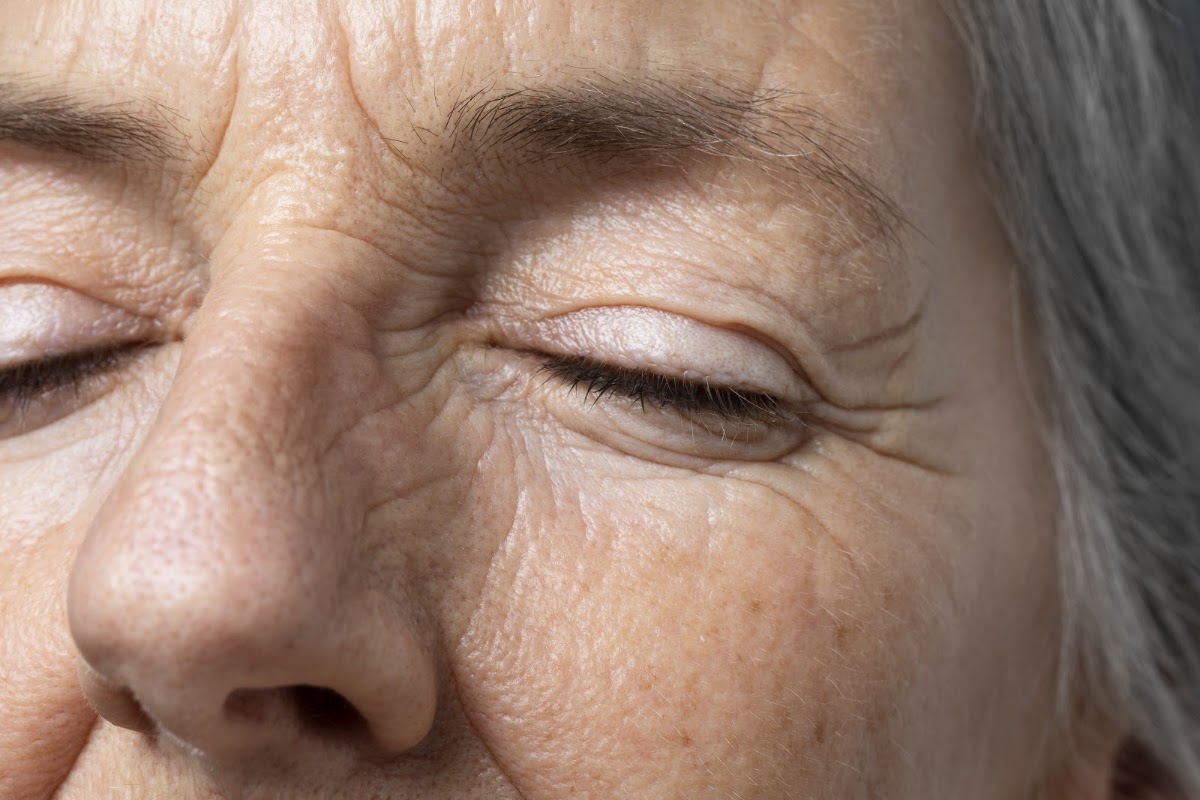 Anti-Wrinkle Injections