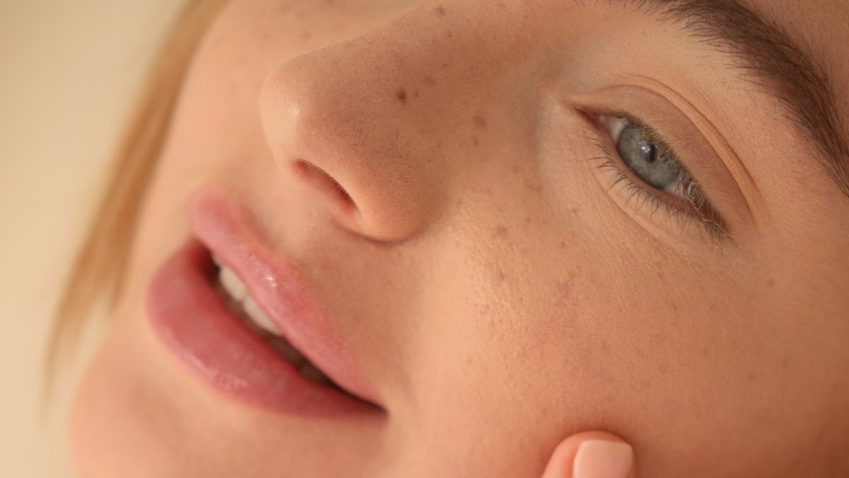 Microneedling