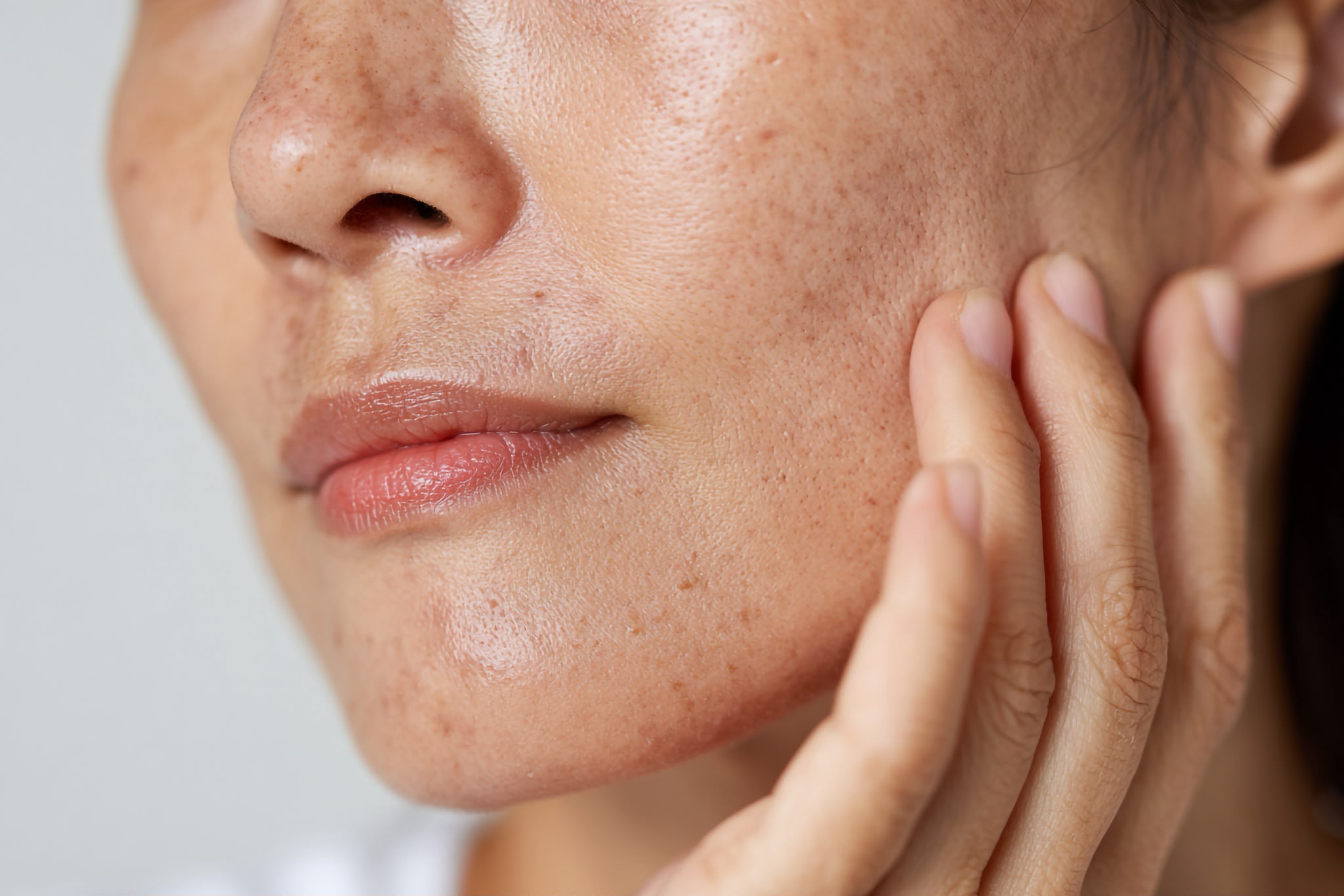 Vein & Pigmentation Removal