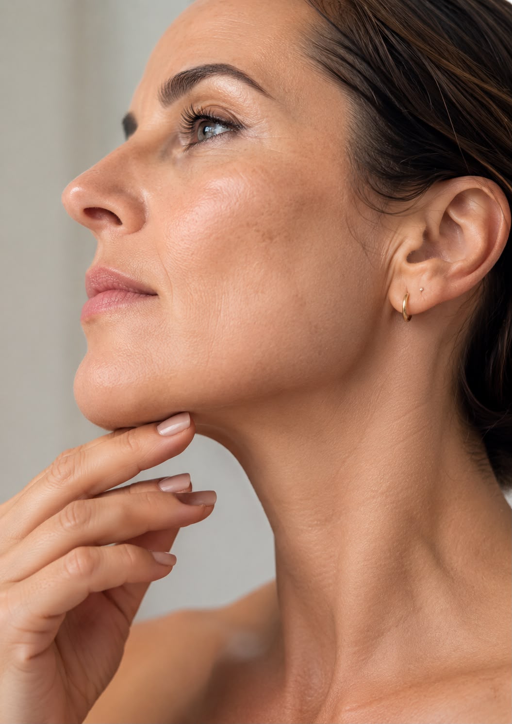 Tighten Loose Skin - Laser Lift